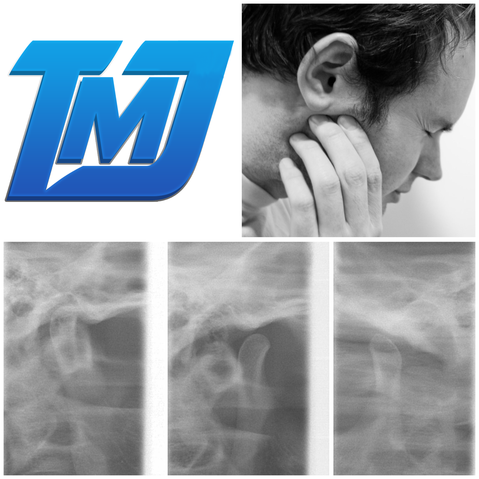 TMJ Pain Treatment NYC