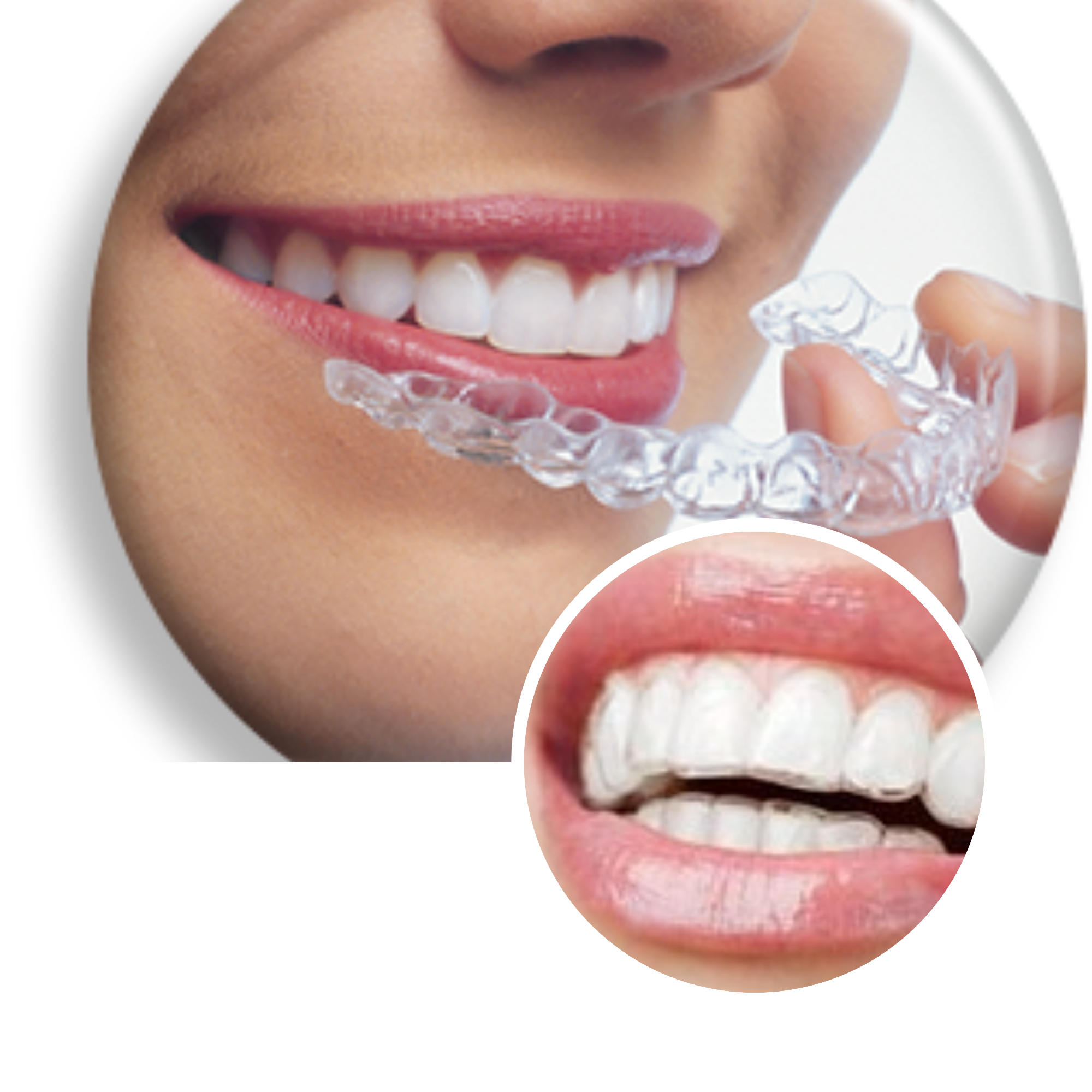 Invisalign in NYC