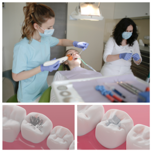 NYC Dentist performing a cavity filling procedure on a patient