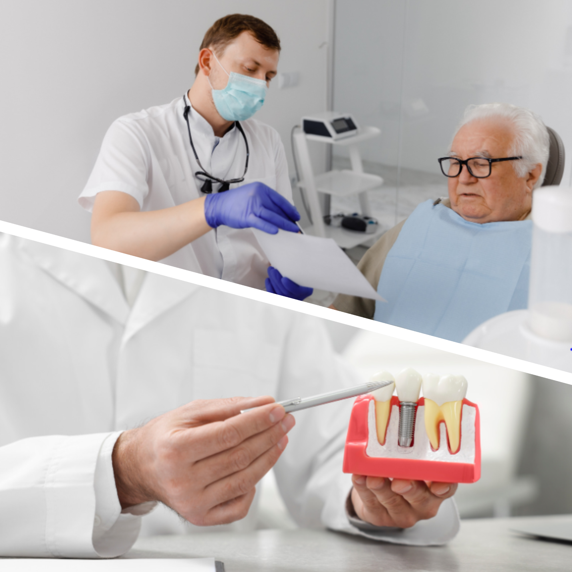 Best Dental Implants in NYC