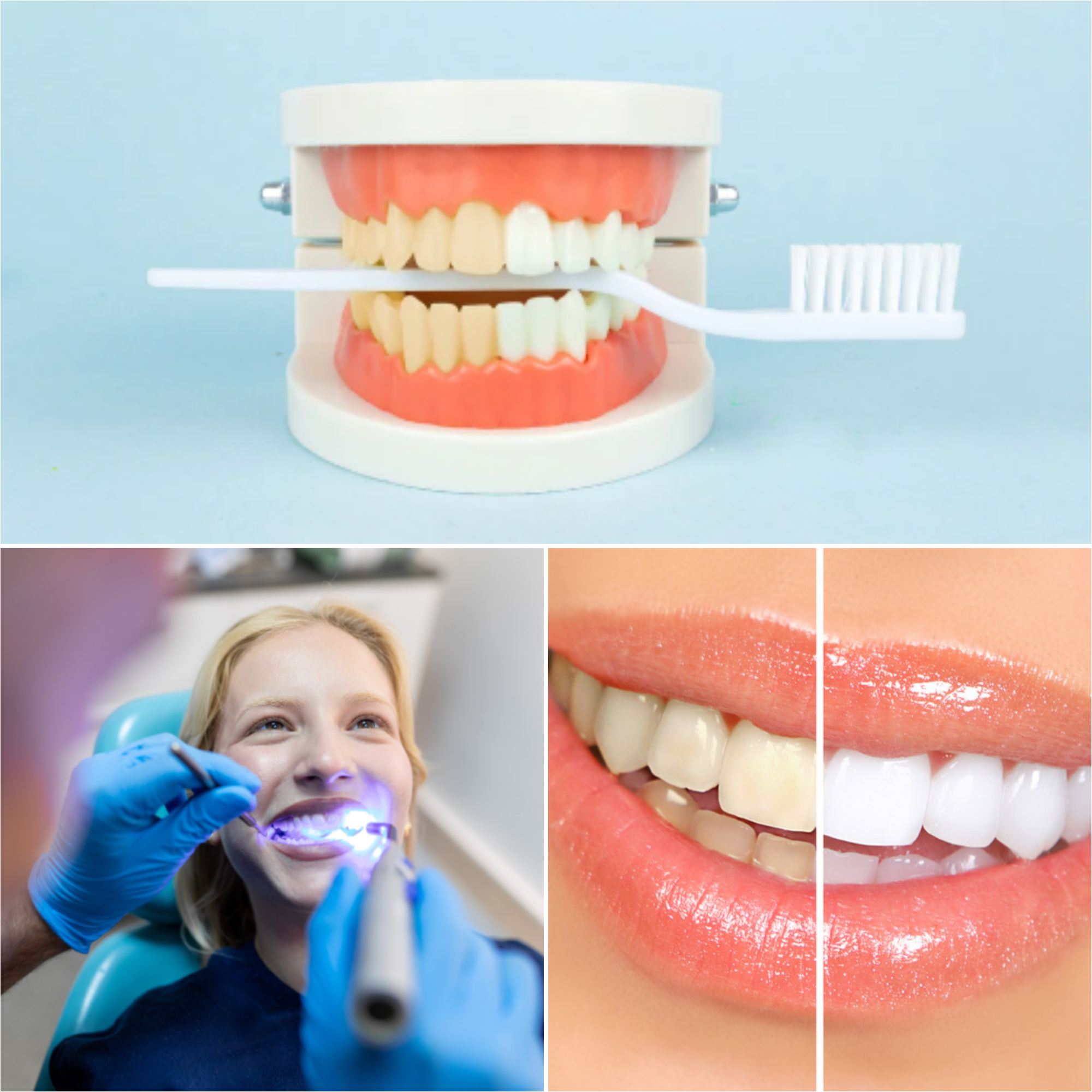 Best Teeth Whitening in NYC