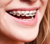 Person smiling while wearing braces