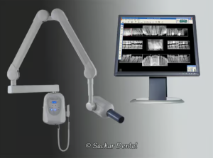 Digital Dental X-rays