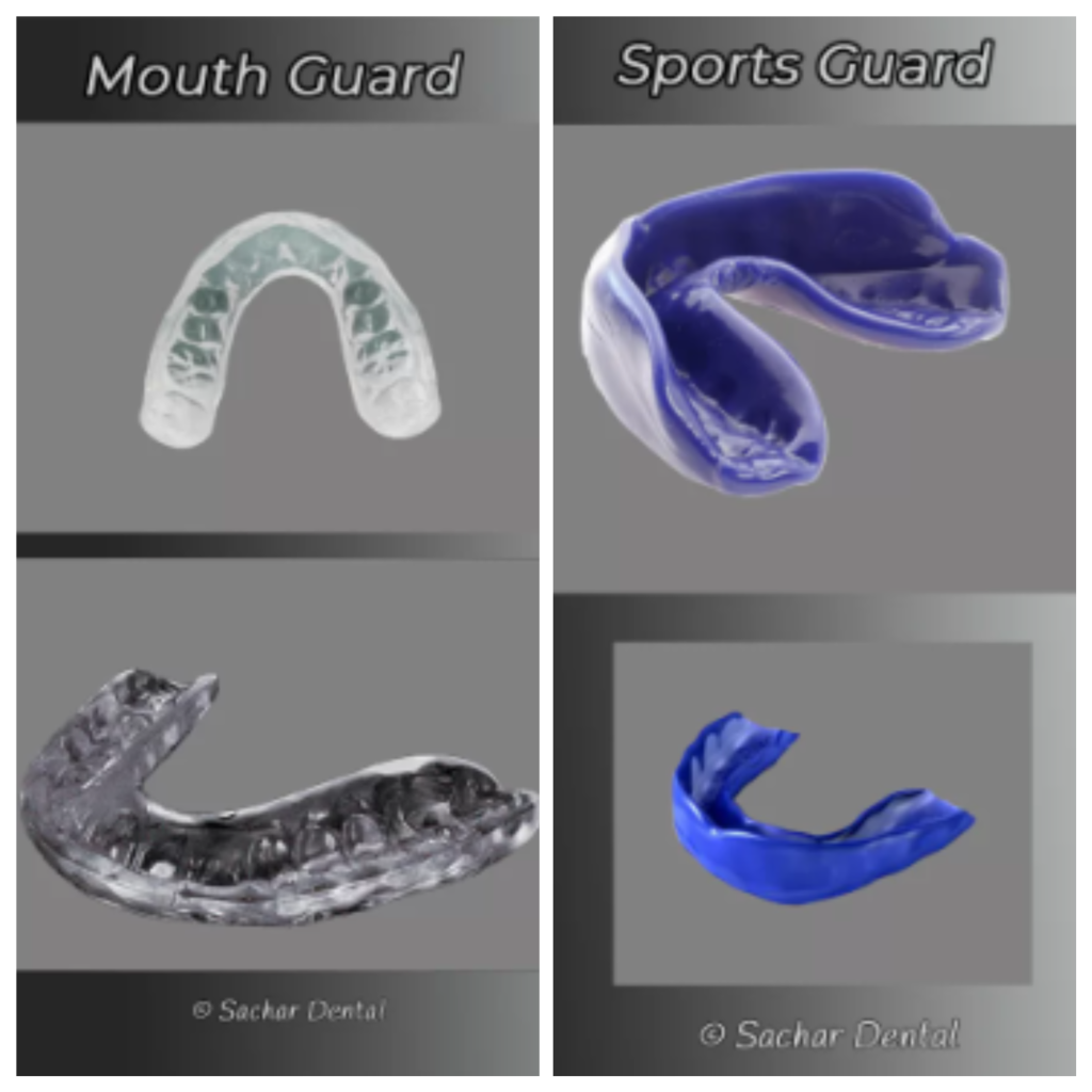 Custom Mouthguards NYC