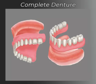 Image of traditional dentures displayed on a neutral background, highlighting their removable design and gum-colored base.