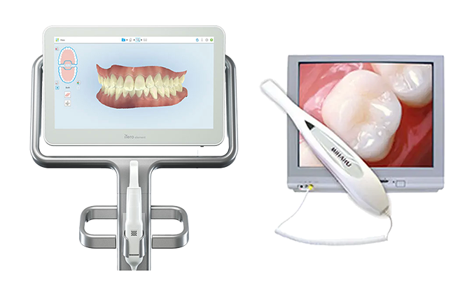 Latest technology NYC dental care - image of intraoral cameras and itero scanner