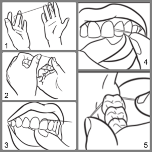 Flossing and Oral Health