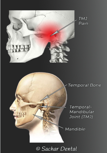 TMJ Diagnosis and Treatment