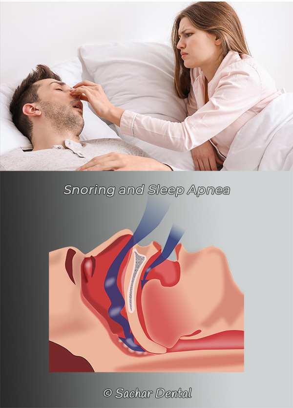 Sleep apnea and snoring NYC