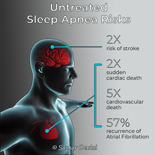 Snoring and Sleep Apnea risks chart